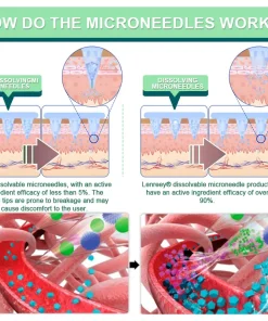 Lenreey® NIDDK-Tirzepatide Slimming & health NANO MICRONEEDLE PATCH