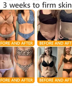 Made and Shipped from USA ✨ PUROSA® Bee Venom Wrinkle-Firming Multi-purpose Cream