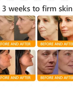 Made and Shipped from USA ✨ PUROSA® Bee Venom Wrinkle-Firming Multi-purpose Cream