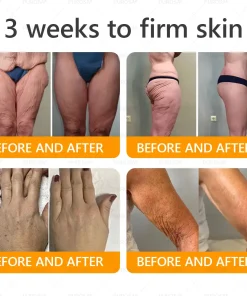 Made and Shipped from USA ✨ PUROSA® Bee Venom Wrinkle-Firming Multi-purpose Cream