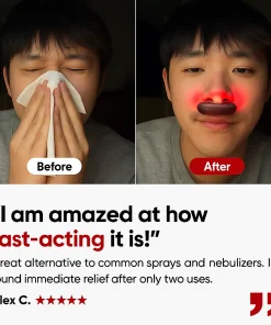 Nuv® - Sinus Relief