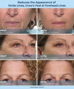 Plexadern™ 60-Second Anti-Aging Serum