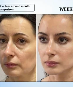 ϹΟRΟU® Nano Microneedle Wrinkle Patch