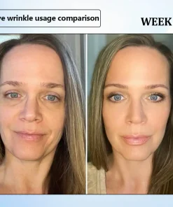 ϹΟRΟU® Nano Microneedle Wrinkle Patch