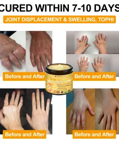 Raindew®Bee Venom Advanced Joint and Bone Healing Cream