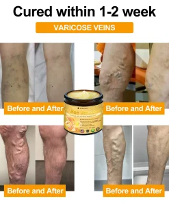 Raindew®Bee Venom Advanced Joint and Bone Healing Cream