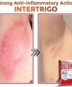 SkinPrikyn™ MicroNeedle Botanic Skin Tag Removal Patch