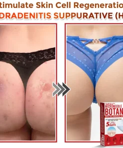 SkinPrikyn™ MicroNeedle Botanic Skin Tag Removal Patch