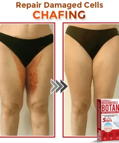 SkinPrikyn™ MicroNeedle Botanic Skin Tag Removal Patch