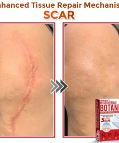 SkinPrikyn™ MicroNeedle Botanic Skin Tag Removal Patch