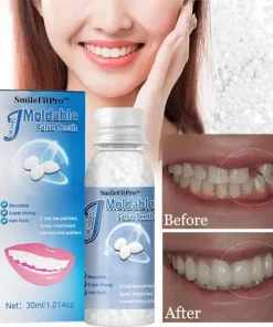 SmileFitPro™ Dental Filling Gel