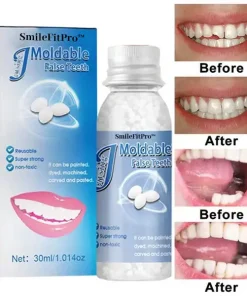 SmileFitPro™ Dental Filling Gel