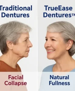 TrueEase™ Custom-Fit Functional Dentures