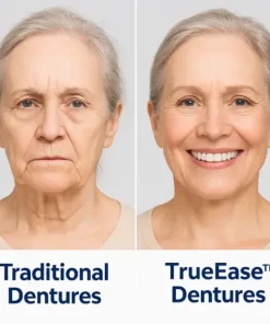 TrueEase™ Custom-Fit Functional Dentures