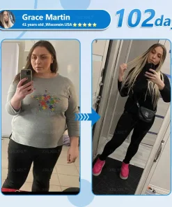 XRLXRL® Nano Microneedle Patch with SMGT-GLP-1 & Matrixyl 3000 – Slimming, Skin Tightening, Blood Sugar Support, No Injection, 7-Day Result