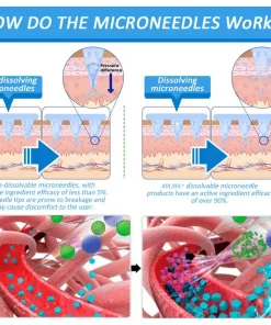 XRLXRL® Nano Microneedle Patch with SMGT-GLP-1 & Matrixyl 3000 – Slimming, Skin Tightening, Blood Sugar Support, No Injection, 7-Day Result