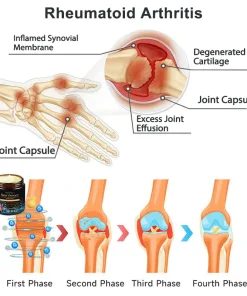 𝐕𝐢𝐨𝐫𝐚𝐥𝐢𝐟𝐞𝐬™ 𝐁𝐞𝐞 𝐕𝐞𝐧𝐨𝐦 𝐚𝐧𝐝 𝐓𝐮𝐫𝐦𝐞𝐫𝐢𝐜 𝐉𝐨𝐢𝐧𝐭 𝐚𝐧𝐝 𝐁𝐨𝐧𝐞 𝐏𝐚𝐢𝐧 𝐑𝐞𝐥𝐢𝐞𝐟 𝐂𝐫𝐞𝐚𝐦