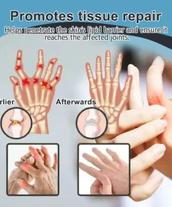 𝐕𝐢𝐨𝐫𝐚𝐥𝐢𝐟𝐞𝐬™ 𝐁𝐞𝐞 𝐕𝐞𝐧𝐨𝐦 𝐚𝐧𝐝 𝐓𝐮𝐫𝐦𝐞𝐫𝐢𝐜 𝐉𝐨𝐢𝐧𝐭 𝐚𝐧𝐝 𝐁𝐨𝐧𝐞 𝐏𝐚𝐢𝐧 𝐑𝐞𝐥𝐢𝐞𝐟 𝐂𝐫𝐞𝐚𝐦