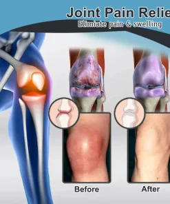 𝐕𝐢𝐨𝐫𝐚𝐥𝐢𝐟𝐞𝐬™ 𝐁𝐞𝐞 𝐕𝐞𝐧𝐨𝐦 𝐚𝐧𝐝 𝐓𝐮𝐫𝐦𝐞𝐫𝐢𝐜 𝐉𝐨𝐢𝐧𝐭 𝐚𝐧𝐝 𝐁𝐨𝐧𝐞 𝐏𝐚𝐢𝐧 𝐑𝐞𝐥𝐢𝐞𝐟 𝐂𝐫𝐞𝐚𝐦