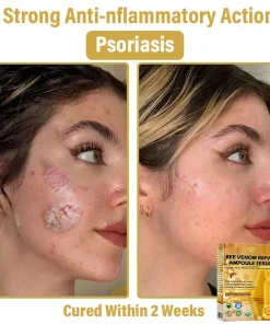 𝐃𝒚𝐜𝐞𝐜𝐨® 𝑩𝒆𝐞 𝑽𝐞𝒏𝒐𝒎 𝑺𝒌𝒊𝒏 𝑹𝐞𝒑𝒂𝒊𝒓 𝑨𝒎𝒑𝒐𝒖𝒍𝐞 𝑺𝐞𝒓𝒖𝒎