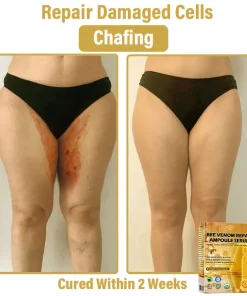 𝐃𝒚𝐜𝐞𝐜𝐨® 𝑩𝒆𝐞 𝑽𝐞𝒏𝒐𝒎 𝑺𝒌𝒊𝒏 𝑹𝐞𝒑𝒂𝒊𝒓 𝑨𝒎𝒑𝒐𝒖𝒍𝐞 𝑺𝐞𝒓𝒖𝒎