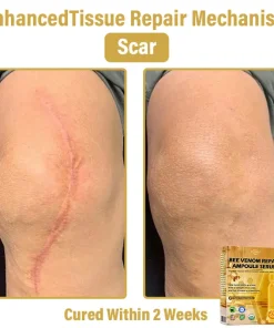 𝐃𝒚𝐜𝐞𝐜𝐨® 𝑩𝒆𝐞 𝑽𝐞𝒏𝒐𝒎 𝑺𝒌𝒊𝒏 𝑹𝐞𝒑𝒂𝒊𝒓 𝑨𝒎𝒑𝒐𝒖𝒍𝐞 𝑺𝐞𝒓𝒖𝒎