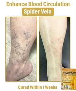 𝐃𝒚𝐜𝐞𝐜𝐨® 𝑩𝒆𝐞 𝑽𝐞𝒏𝒐𝒎 𝑺𝒌𝒊𝒏 𝑹𝐞𝒑𝒂𝒊𝒓 𝑨𝒎𝒑𝒐𝒖𝒍𝐞 𝑺𝐞𝒓𝒖𝒎