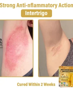 𝐃𝒚𝐜𝐞𝐜𝐨® 𝑩𝒆𝐞 𝑽𝐞𝒏𝒐𝒎 𝑺𝒌𝒊𝒏 𝑹𝐞𝒑𝒂𝒊𝒓 𝑨𝒎𝒑𝒐𝒖𝒍𝐞 𝑺𝐞𝒓𝒖𝒎