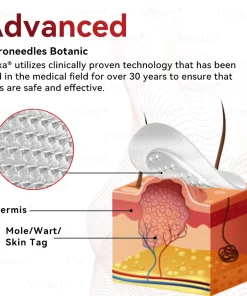 𝑉𝑠𝑜𝑥𝑎® 𝑀𝑖𝑐𝑟𝑜𝑛𝑒𝑒𝑑𝑙𝑒𝑠 𝐵𝑜𝑡𝑎𝑛𝑖𝑐 𝑆𝑘𝑖𝑛 𝑇𝑎𝑔𝑠 𝑆𝑜𝑙𝑢𝑡𝑖𝑜𝑛 𝑃𝑎𝑡𝑐ℎ𝑒𝑠