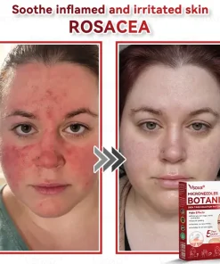 𝑉𝑠𝑜𝑥𝑎® 𝑀𝑖𝑐𝑟𝑜𝑛𝑒𝑒𝑑𝑙𝑒𝑠 𝐵𝑜𝑡𝑎𝑛𝑖𝑐 𝑆𝑘𝑖𝑛 𝑇𝑎𝑔𝑠 𝑆𝑜𝑙𝑢𝑡𝑖𝑜𝑛 𝑃𝑎𝑡𝑐ℎ𝑒𝑠