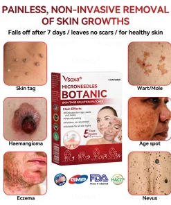 𝑉𝑠𝑜𝑥𝑎® 𝑀𝑖𝑐𝑟𝑜𝑛𝑒𝑒𝑑𝑙𝑒𝑠 𝐵𝑜𝑡𝑎𝑛𝑖𝑐 𝑆𝑘𝑖𝑛 𝑇𝑎𝑔𝑠 𝑆𝑜𝑙𝑢𝑡𝑖𝑜𝑛 𝑃𝑎𝑡𝑐ℎ𝑒𝑠