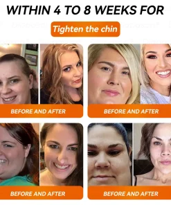 𝐷𝑖𝑎𝑝𝑎𝑠𝑜𝑛® 𝑁𝐴𝐷+ 𝐺𝐿𝑃-1 𝑆𝑙𝑖𝑚𝑚𝑖𝑛𝑔 𝐷𝑟𝑜𝑝𝑠