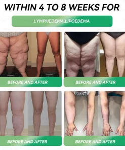 𝐁𝐨𝒔𝒕𝗼𝗿𝗲® 𝐺𝑳𝐏 -1 𝐌𝐢𝐜𝒓𝒐𝒄𝒂𝒑𝘀𝘂𝗹𝗲 𝗕𝘂𝗿𝐬𝐭 𝑷𝒂𝙩𝙘𝙝