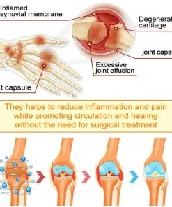 ADFIRE® Bee Venom Pain-Relief Bone Healing Spray