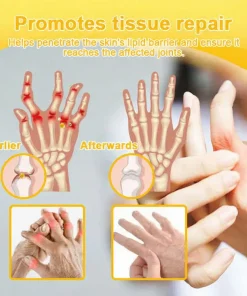 ADFIRE® Bee Venom Pain-Relief Bone Healing Spray