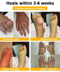 ADFIRE® Bee Venom Pain-Relief Bone Healing Spray