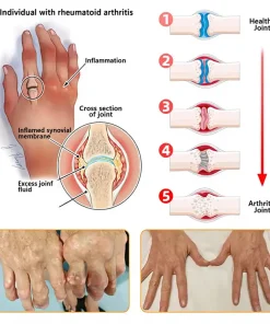 ADFIRE® Bee Venom Pain-Relief Bone Healing Spray