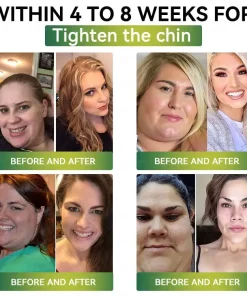 ADFIRE® GLP-1 Slimming Patch