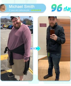 ADFIRE® NIDDK-Tirzepatide Slimming & health NANO MICRONEEDLE PATCH