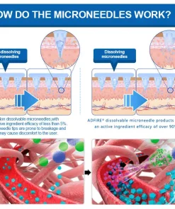 ADFIRE® SMGT-GLP-1 𝐓𝐢𝐫𝐳𝐞𝐩𝐚𝐭𝐢𝐝𝐞 & 𝐂𝐨𝐥𝐥𝐚𝐠𝐞𝐧 𝐍𝐚𝐧𝐨 𝐌𝐢𝐜𝐫𝐨𝐧𝐞𝐞𝐝𝐥𝐞 𝐖𝐞𝐢𝐠𝐡𝐭 𝐋𝐨𝐬𝐬 𝐏𝐚𝐭𝐜𝐡