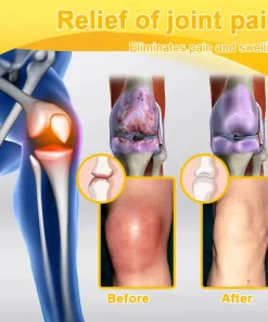 AQA™ Botulinum & Bee Essence Pain-Relief Bone Healing Cream