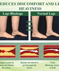 ATTDX® ChestnutEase Edema Massage Herbal Cream