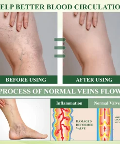 ATTDX® ChestnutEase Edema Massage Herbal Cream