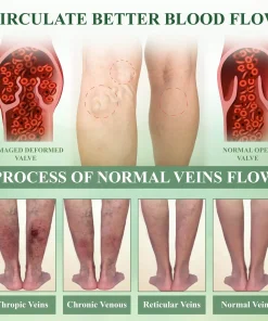 ATTDX® ChestnutEase Edema Massage Herbal Cream