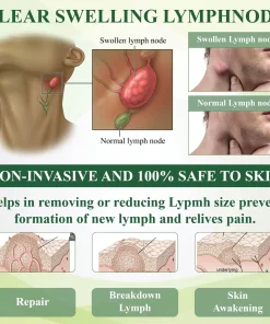 ATTDX® ChestnutEase Edema Massage Herbal Cream