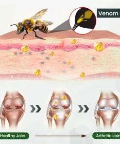 Adfire® Bee Venom Bone & Joint Revive Spray