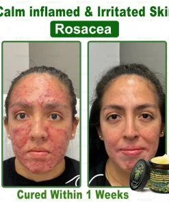 Bellelala® Bee Venom Multi-Care Repair Cream