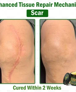 Bellelala® Bee Venom Multi-Care Repair Cream