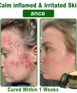 Bellelala® Bee Venom Multi-Care Repair Cream