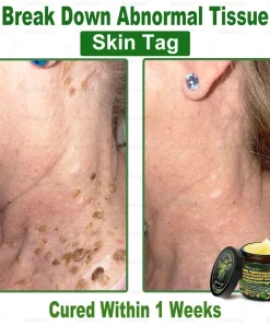 Bellelala® Bee Venom Multi-Care Repair Cream